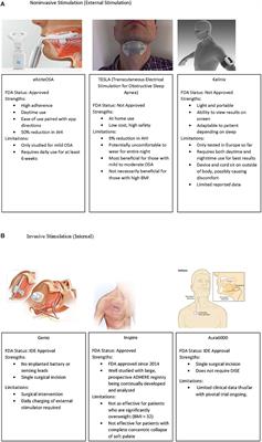 Beyond CPAP: modifying upper airway output for the treatment of OSA